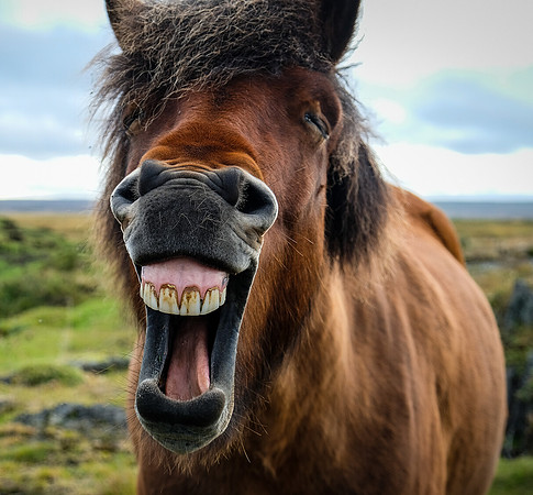 Overbite